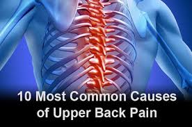 causes of upper back pain