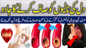 How To Clean Arteries Remove Bad Cholesterol Urdu Hindi