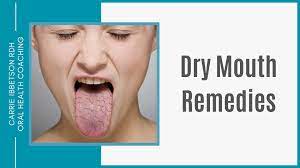dry mouth remes 5 effective home