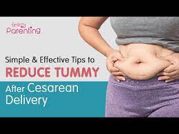 reduce belly after a c section delivery