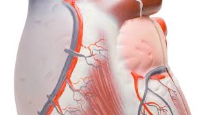 Eine herzmuskelentzündung (myokarditis) ist ein akuter oder ein chronisch verlaufender entzündungsprozess im herzmuskel. á… Herzmuskelentzundung Ursachen Symptome Und Behandlung