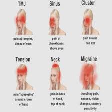 Sinus Headache Location Chart Sinusitis