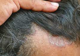12 causes of an itchy scalp according