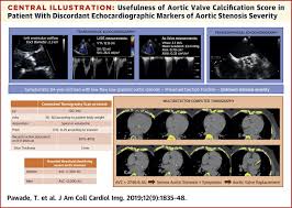 Measure Aortic Valve Calcification