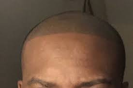 permanent makeup for bald head
