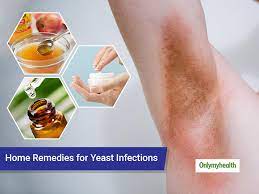 how to treat yeast infections at home