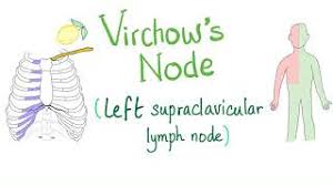 left supraclavicular lymph node