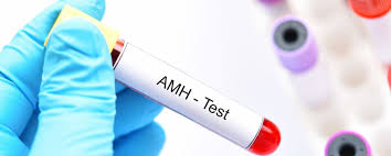 Anti Müllerian Hormone Amh Test 6 Things You Should Know