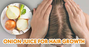 trying onion juice for hair growth