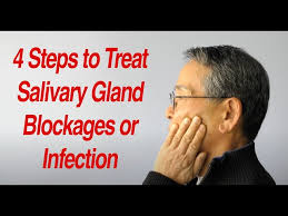 treat salivary gland swelling