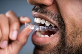 After all, retention devices are a form of braces anyway. Retainers After Braces Invisalign Andover Orthodontics