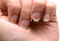 weak nails here are some nutrients you