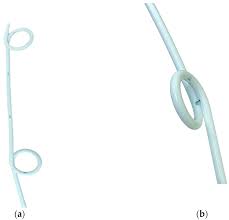 double pigtail drainage catheter