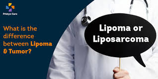 difference between lipoma tumor