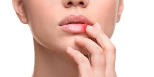 how can you get rid of cold sores