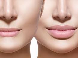 clinics for lip reduction in bangkok