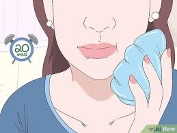 Anesthesia or local anesthesia choices are used for the surgery of wisdom teeth, though it is a painful and discomfort process but it hurts less than any. How To Reduce Wisdom Tooth Swelling 10 Steps With Pictures