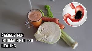 fastest cure for ulcer cabbage juice