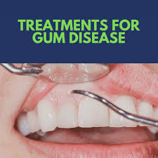 treatments for gum disease needham