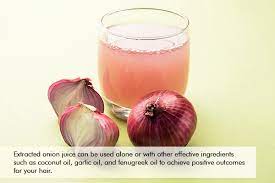 how to use onion juice for dandruff