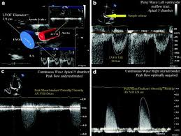 Echocardiography Springerlink