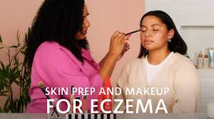 skincare tips for eczema flare ups