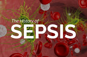 Sepsis is a serious medical condition. The History Of Sepsis I Rot