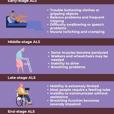 ses of amyotrophic lateral sclerosis