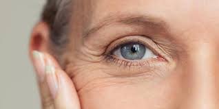 here s what you can do about eye wrinkles