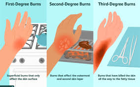 rug burns symptoms severity treatment