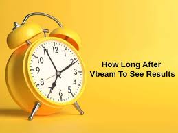 how long after vbeam to see results