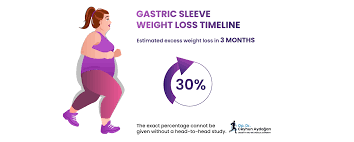 what is a gastric sleeve sleeve