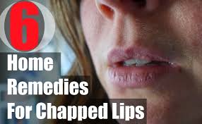 chapped lips morpheme remes