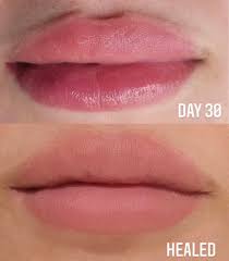 fordyce spots lip blush cover