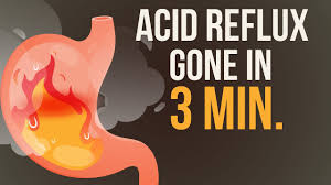 acid reflux heartburn exercises