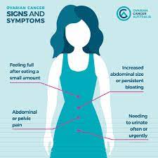 In its early stages, ovarian cancer may not cause symptoms you would notice. Ovarian Cancer Aust Twitterissa There Is Currently No Screening Test For Ovariancancer In That Absence It S Vital That You Know The Main Signs And Symptoms Of This Deadly Disease Go To