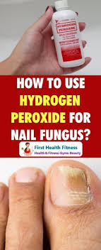 White vinegar and baking soda. How To Use Hydrogen Peroxide For Nail Fungus Toenail Fungus Remedies Nail Fungus Fungi