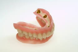 Dentures, removable replacements for missing teeth, are available as partial dentures and complete dentures. Deckprothese Behandlungsablauf Kosten