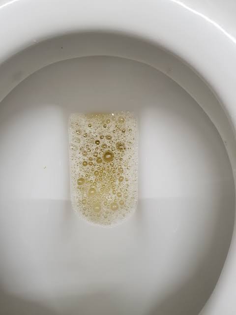 UKidney - Foamy Urine