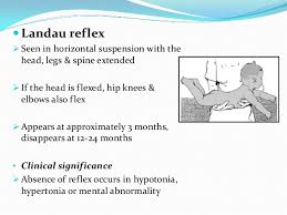 Reflexes Present In Infants