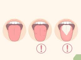 Everything you need to know. How To Clean Your Tongue Properly 11 Steps With Pictures