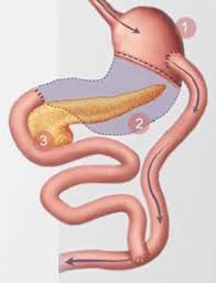 avoid weight gain after gastric byp