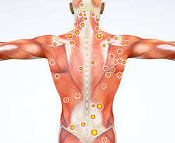 role of trigger points myofascial pain