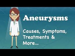 Some may feel nauseous, vomit, become confused, or have a drooping eyelid (further symptoms of a stroke. Aneurysms Causes Symptoms Treatments More Youtube