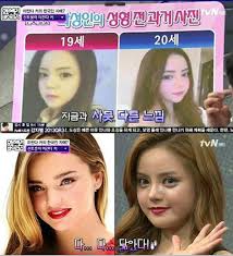 korean woman gets plastic surgery to