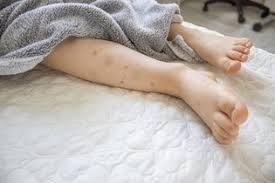white spots on skin 9 causes what