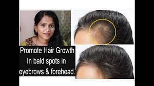 Adding it to your diet or consuming supplements can aid in hair growth. How To Promote Hair Growth In Bald Areas Like Forehead Eyebrows Youtube