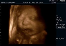 Etwa ab der 30.ssw sind die merkmale und gesichtszüge des babys im 3d ultraschallbild gut zu erkennen. 3d 4d Ultraschall Frauenarzt Saarlouis Dr Daub