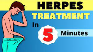 herpes treatment herpes