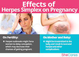 herpes simplex and getting pregnant